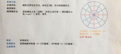 ​免疫组化结果怎么看（一张表教你看懂病理免疫组化报告）