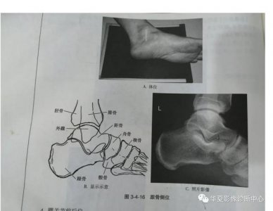 ​体位动作图示健康知识科普（这些常见体位你能否一眼扫过又能一语中的）