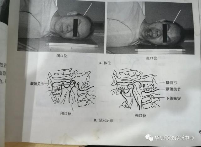 体位动作图示健康知识科普（这些常见体位你能否一眼扫过又能一语中的）(5)