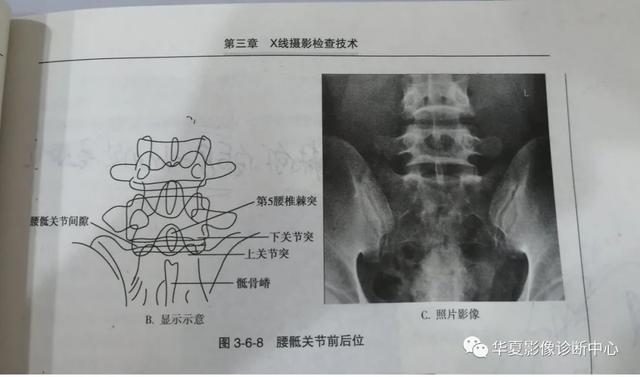 体位动作图示健康知识科普（这些常见体位你能否一眼扫过又能一语中的）(8)