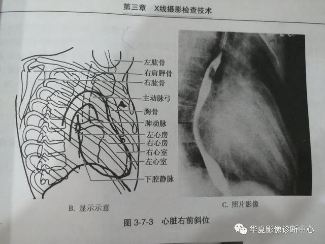 体位动作图示健康知识科普（这些常见体位你能否一眼扫过又能一语中的）(9)