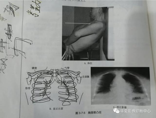 体位动作图示健康知识科普（这些常见体位你能否一眼扫过又能一语中的）(11)