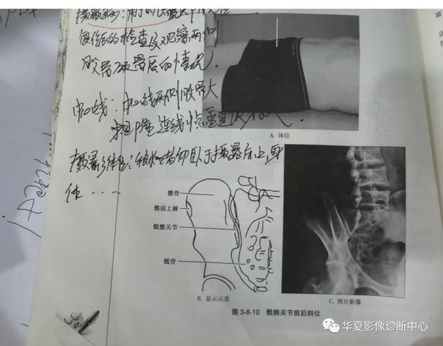 体位动作图示健康知识科普（这些常见体位你能否一眼扫过又能一语中的）(7)