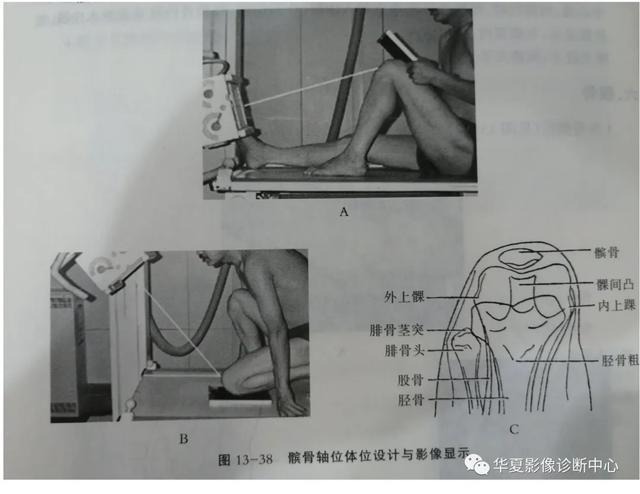 体位动作图示健康知识科普（这些常见体位你能否一眼扫过又能一语中的）(3)