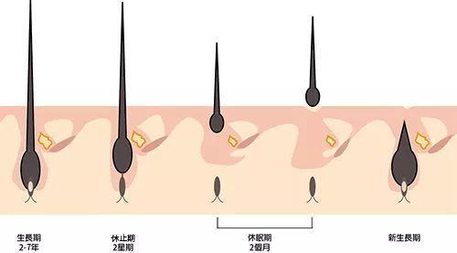 徐峥自曝20岁就秃头 ，被同学嘲笑！